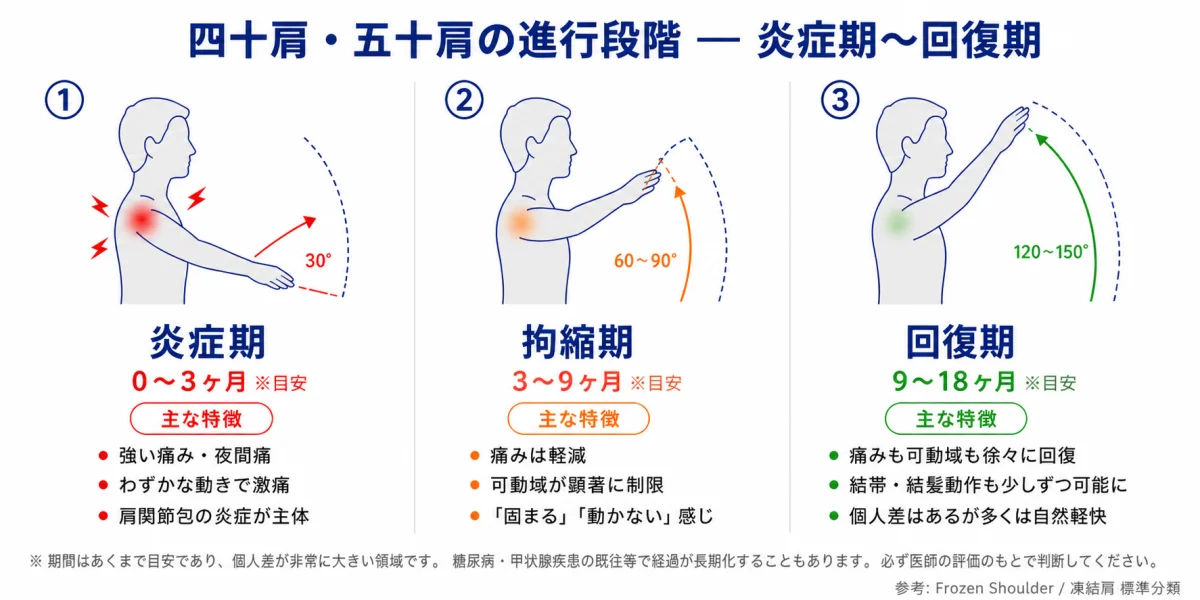 四十肩・五十肩の進行段階 — 炎症期(0〜3ヶ月)・拘縮期(3〜9ヶ月)・回復期(9〜18ヶ月)