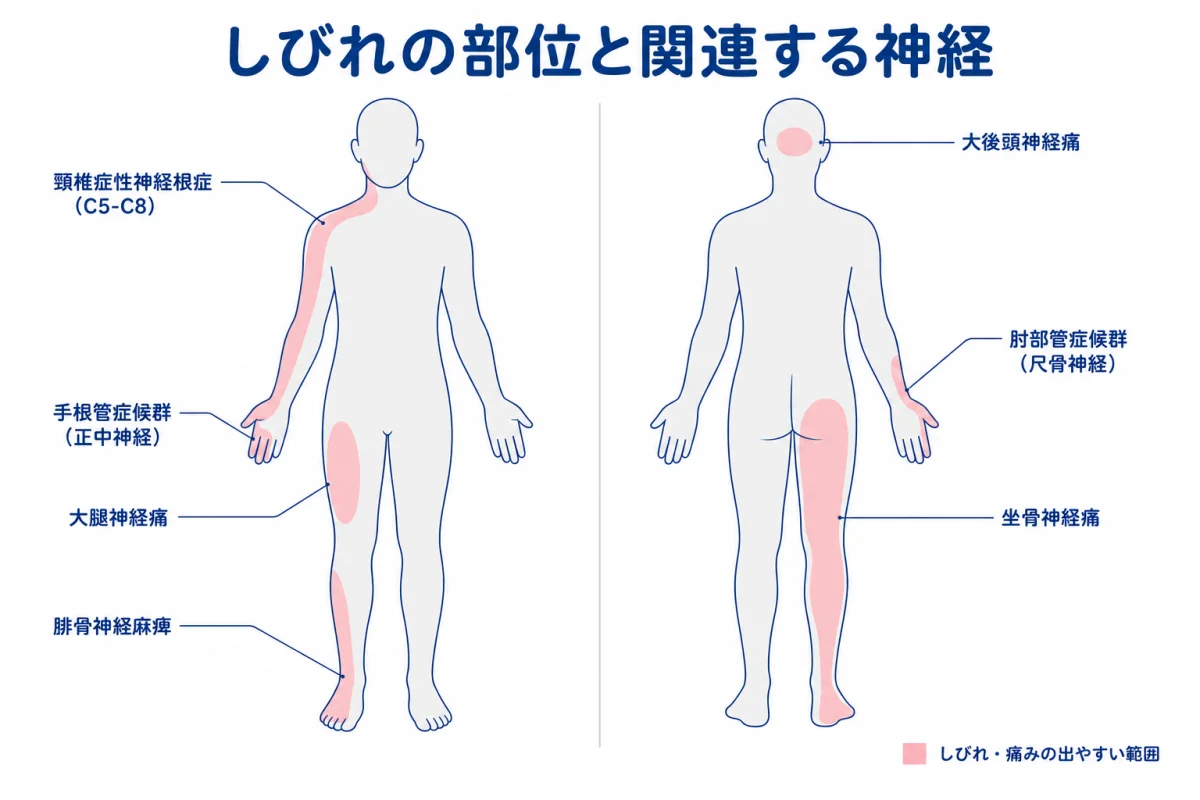 しびれの部位と関連する神経 — 頸椎症性神経根症・手根管症候群・尺骨神経・大腿神経・坐骨神経・腓骨神経・大後頭神経のしびれ範囲マップ