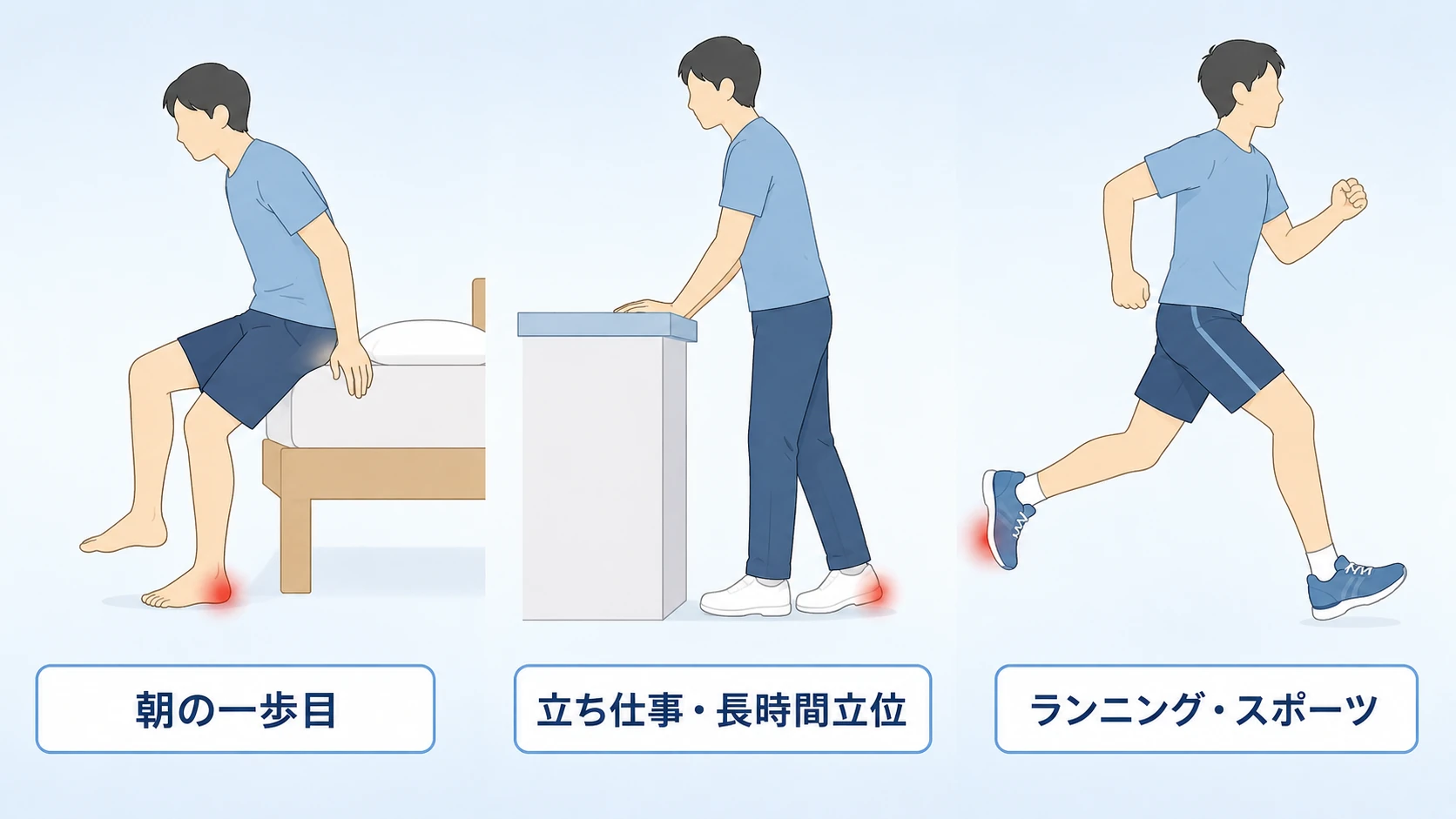 足底腱膜炎の3タイプの患者像 — 朝の一歩目でかかとが痛む朝痛主訴型、立ち仕事・長時間立位でかかとに負担がかかる立ち仕事過用型、ランニングやスポーツでかかとを痛めるランナー型