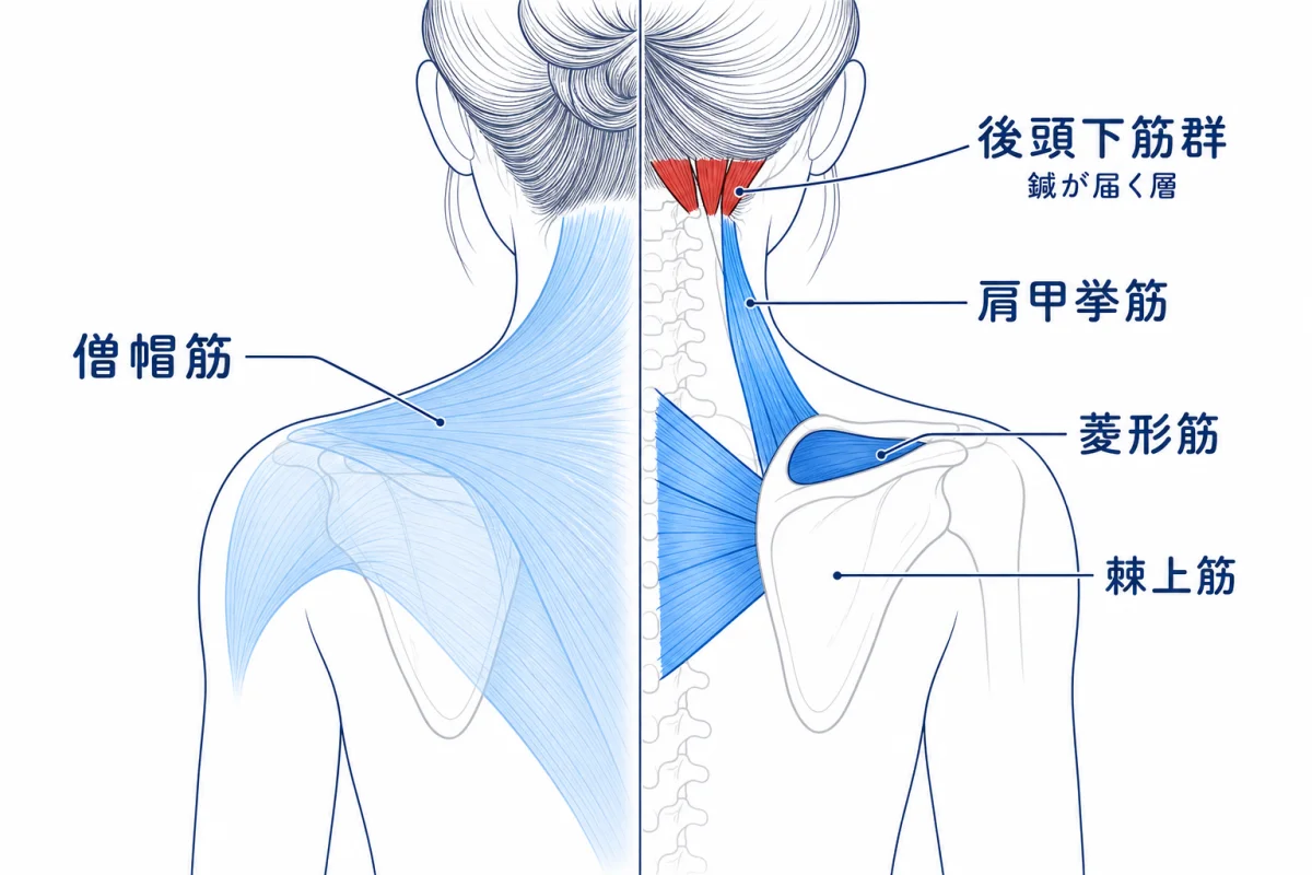 肩甲骨周辺筋群の解剖図 — 僧帽筋・肩甲挙筋・菱形筋・棘上筋と、最深層の後頭下筋群の層構造