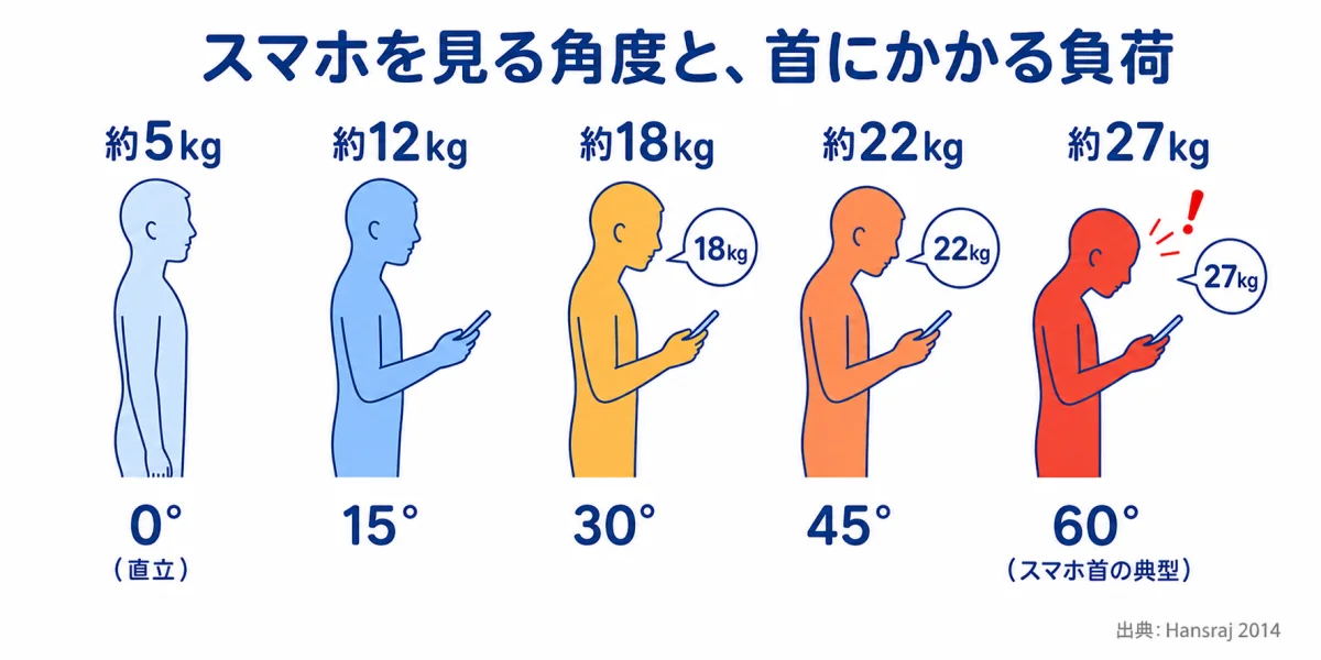 スマホを見る角度別の頸椎負荷比較 — 0度約5kg、15度約12kg、30度約18kg、45度約22kg、60度約27kg(出典: Hansraj 2014)